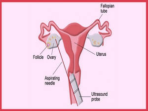 Ovulation Induction KNOW MORE