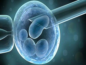 Intracytoplasmic Morphologically Selected Sperm Injection(IMSI) KNOW MORE
